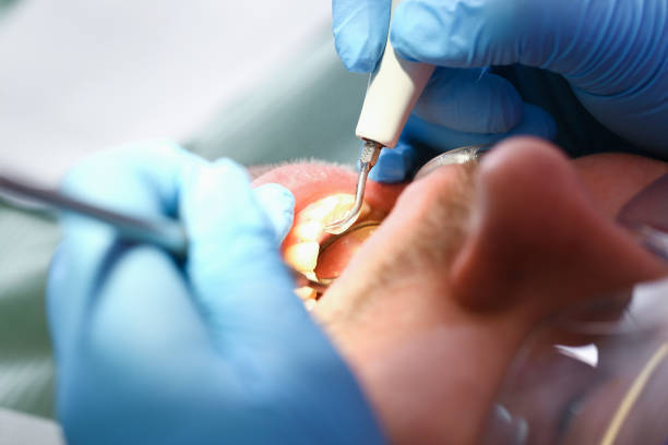 Best Teeth Whitening  in East Lexington, VA